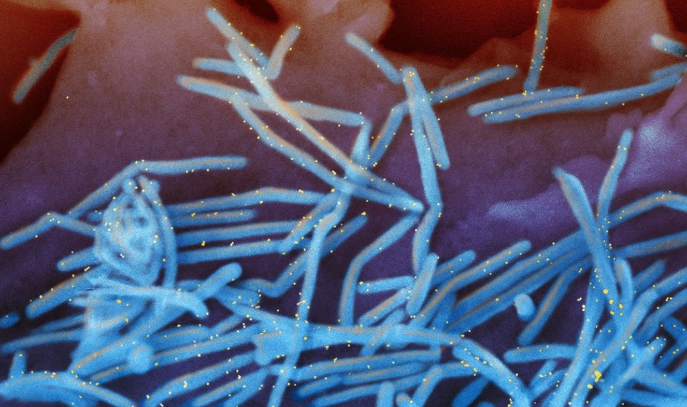 RSV正在孩子们身上卷土重来。RSV症状与新冠病毒症状相比有哪些？